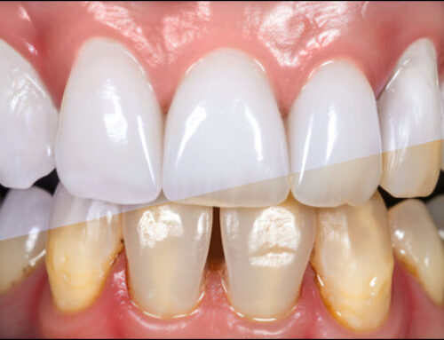 Transformative Cosmetic Dental Treatments