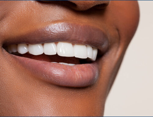 Fixing Your Smile: Transformative Solutions for a Perfect Grin