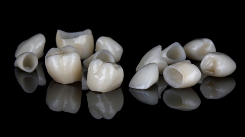 Dental Crowns