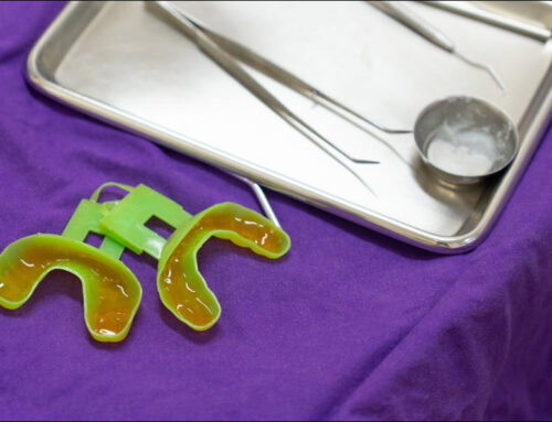 Fluoride Treatments Promote Oral Health