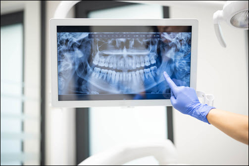 X-Rays